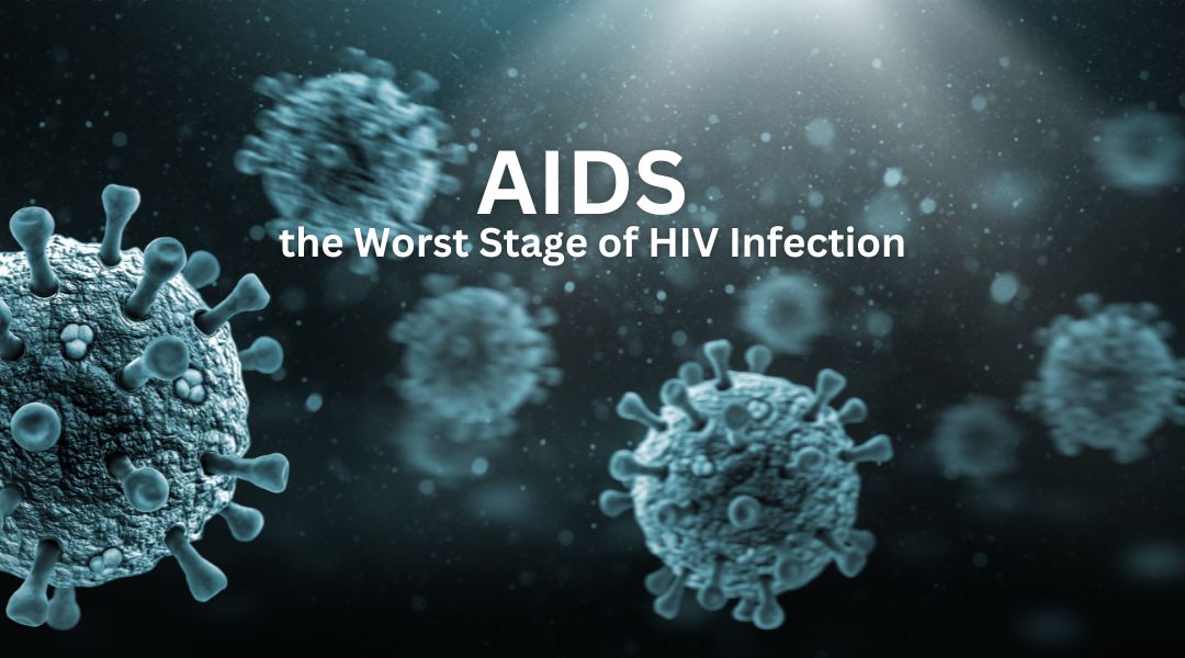 AIDS the Worst Stage of HIV Infection