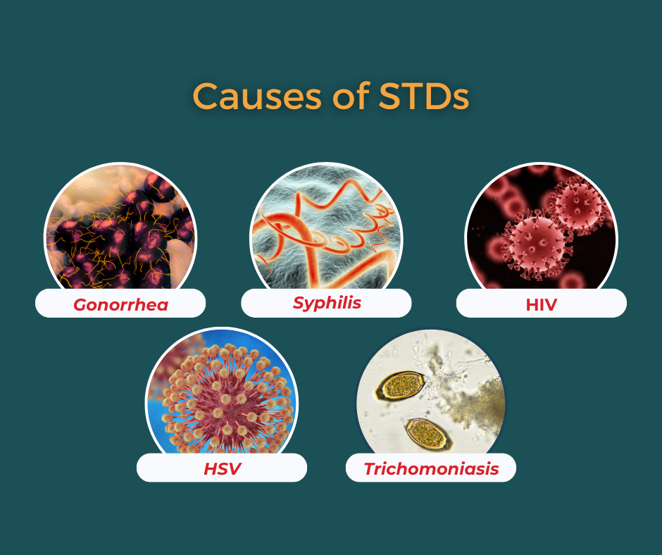 Causes of STDs